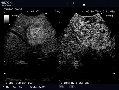 Contrast Harmonic Imaging (CHI)