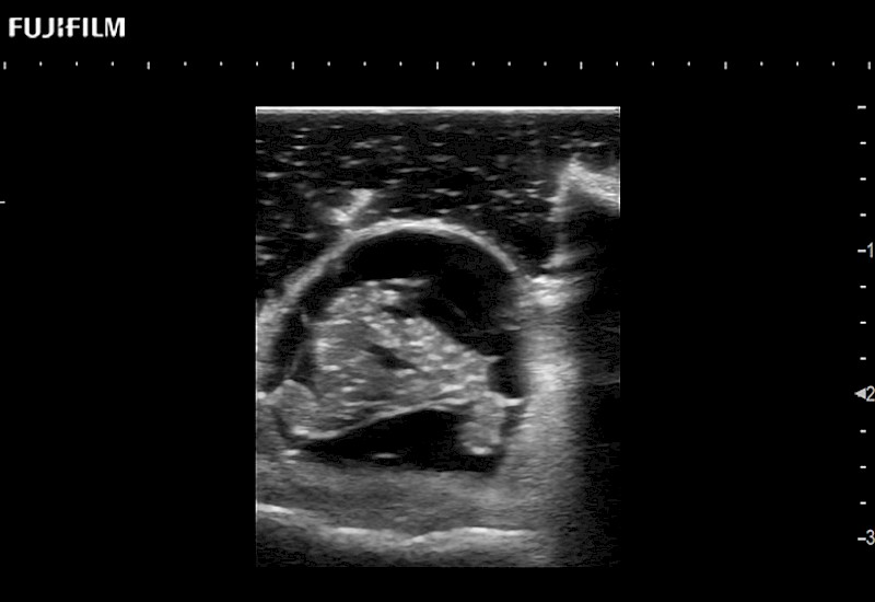 Intraop Spine Cross Section