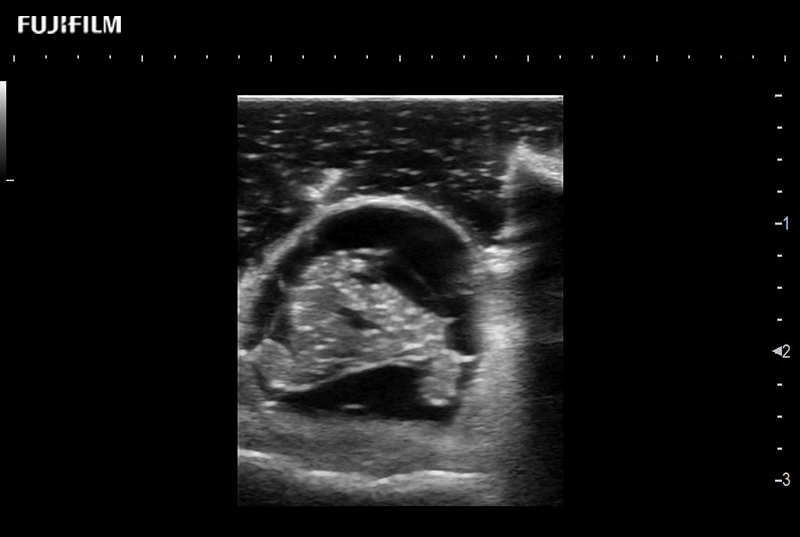 Intraop Spine Cross Section